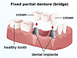 Columbia Prime Dental, Columbia, MD Dentists